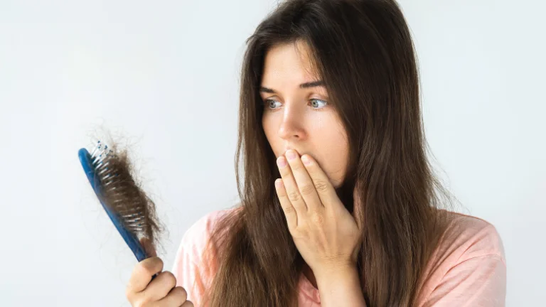 Vitiligo Nedir, Belirtileri ve Tedavisi Nelerdir?